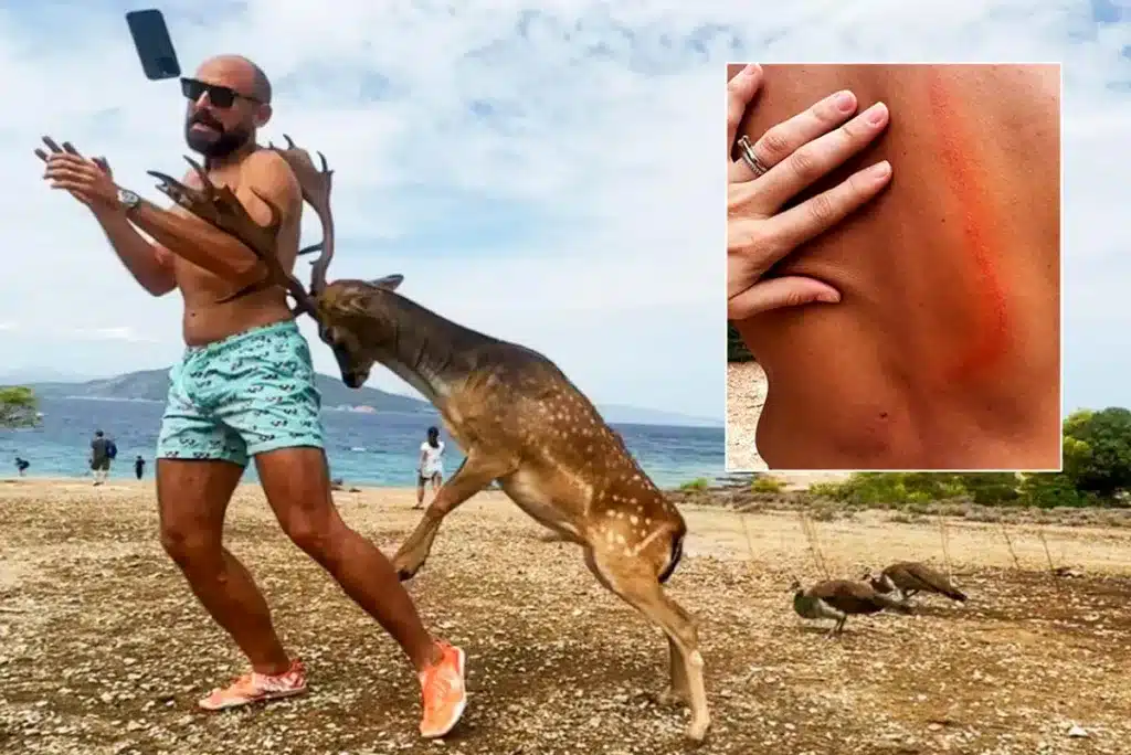 Imagen del ataque y la lesión provocada